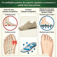 🔷 30% de desconto hoje ⬛⏰ Acabamento premium em camurça fosca; marca australiana de luxo; macios e confortáveis; calce e descalce em segundos 🦶 Calçados ergonômicos corretivos para caminhar – Unissex